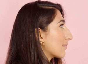 What Is The #SideProfileSelfie Campaign? Radhika Sanghani Celebrates Big Noses