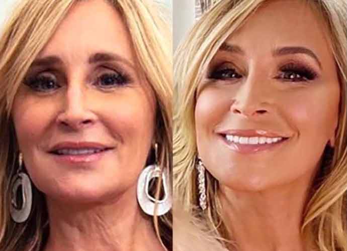 Sonja Morgan, The Real Housewives Of New York’ Star, Reveals $75,000 Facelift