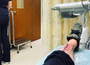 'Jackass' Star Bam Margera Hospitalized With Staph Infection On New Tattoo (Image: Instagram)
