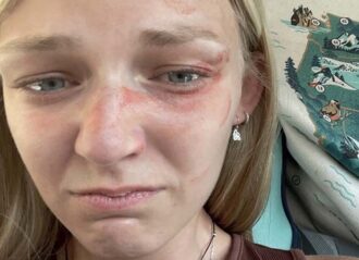 Gabby Petito's selfie shows bruised face before murder (Image: Twitter)