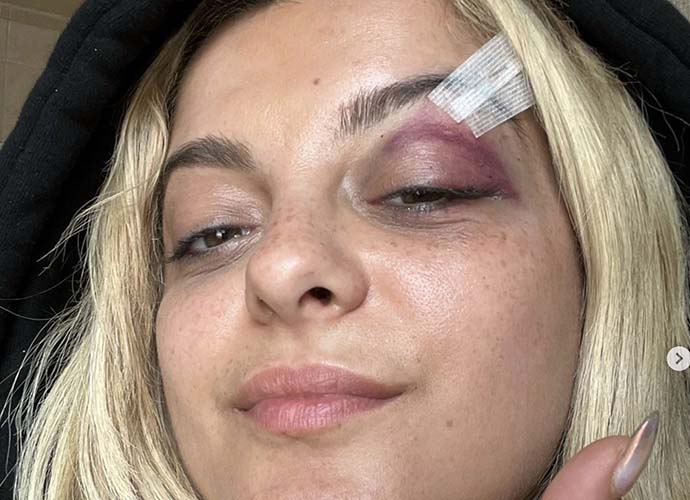 Bebe Rexha injured after a phone hits her face during a concert (Image: Instagram)