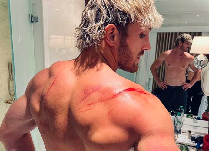 Logan Paul shows off injuries after WWE fight (Image: Twitter)