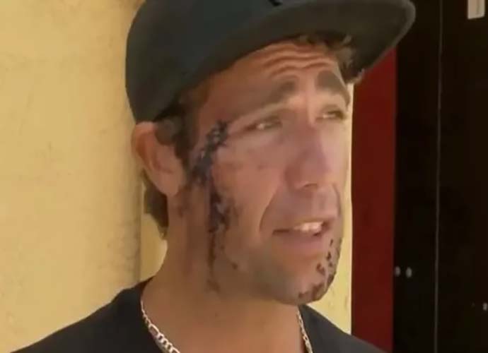 Surfer Mark Sumersett after shark bites him in the face (Image: YouTube)