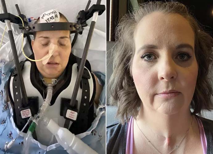 Christy Bullock Survives Internal Decapitation In Horrific Motorcycle Accident