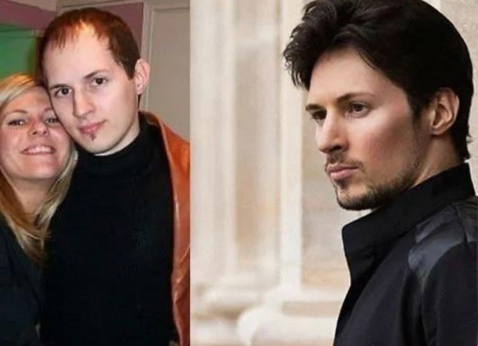 After Arrest In Paris, Telegram CEO Pavel Durov Is Accused Of Having Plastic Surgery & Getting Hair Plugs On Social Media